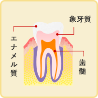 初期のむし歯(C0)