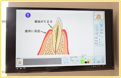 説明用モニター