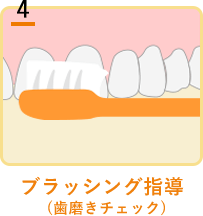 ブラッシング指導(歯磨きチェック)