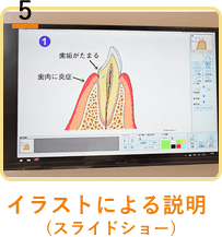 イラストによる説明(スライドショー)