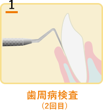 歯周病検査(2回目)