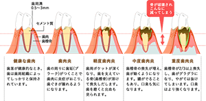 症状と進行