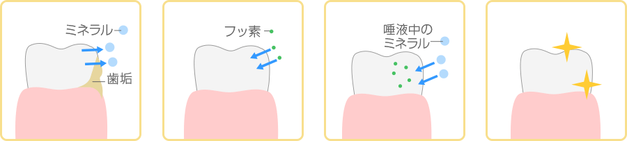 フッ素塗布で歯を強化！