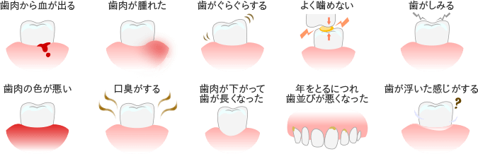 歯周病